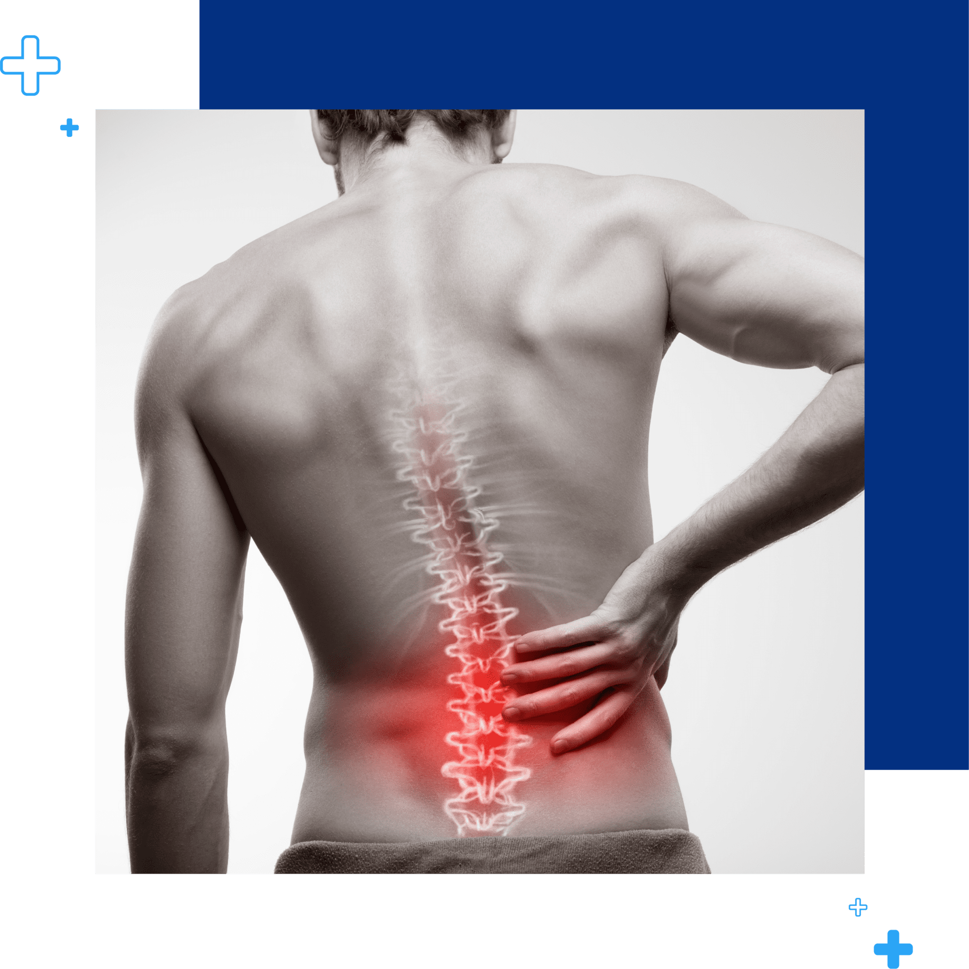 Información sobre Hernia de disco